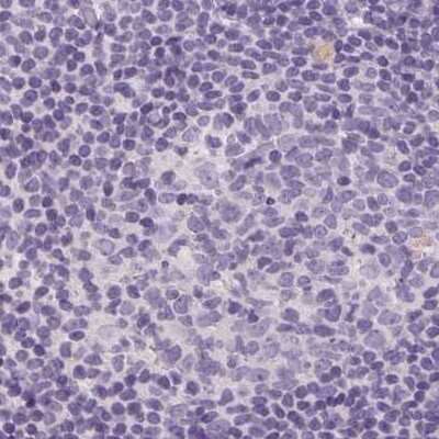Immunohistochemistry-Paraffin: 17 beta-HSD1/HSD17B1 Antibody [NBP2-39053]