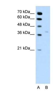 Western Blot: 17 beta-HSD1/HSD17B1 Antibody [NBP1-56295]