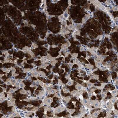 Immunohistochemistry-Paraffin: 17 beta-HSD14/HSD17B14 Antibody [NBP1-85220]