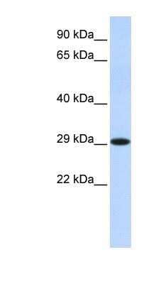 Western Blot: 17 beta-HSD14/HSD17B14 Antibody [NBP1-57625]