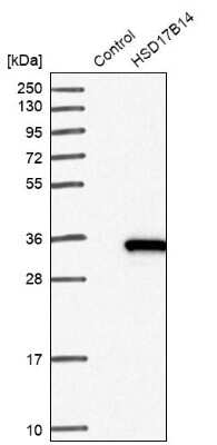 Western Blot: 17 beta-HSD14/HSD17B14 Antibody [NBP1-85220]