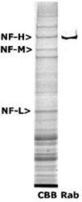 Western Blot: NF-H Antibody [NB300-135]