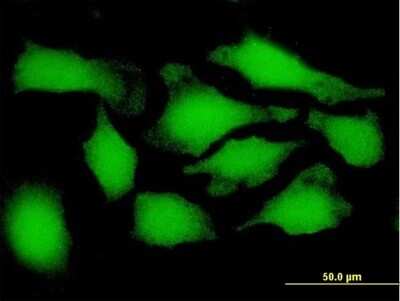 Immunocytochemistry/ Immunofluorescence: 26S proteasome subunit 9 Antibody [H00005715-B01P]