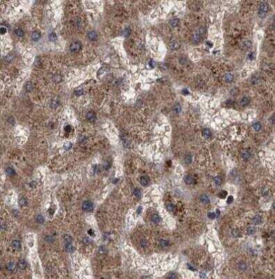 Immunohistochemistry-Paraffin: 26S proteasome subunit 9 Antibody [NBP2-47561]