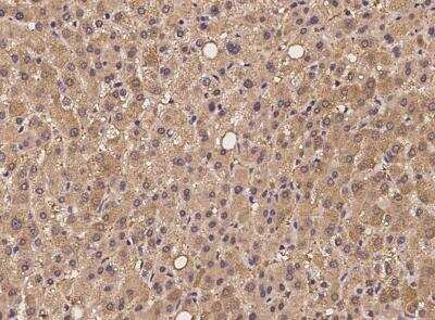 Immunohistochemistry-Paraffin: 26S proteasome subunit 9 Antibody [NBP3-05933]