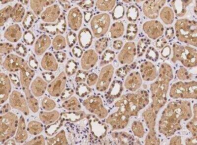 Immunohistochemistry-Paraffin: 26S proteasome subunit 9 Antibody [NBP3-05933]