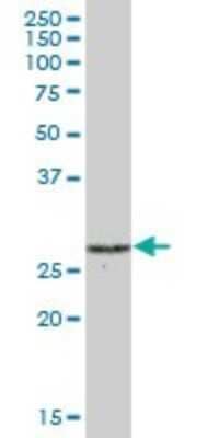 Western Blot: 26S proteasome subunit 9 Antibody [H00005715-B01P]