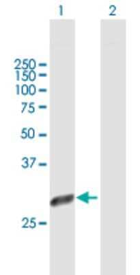 Western Blot: 26S proteasome subunit 9 Antibody [H00005715-B01P]