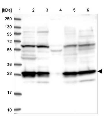 Western Blot: 26S proteasome subunit 9 Antibody [NBP2-47561]