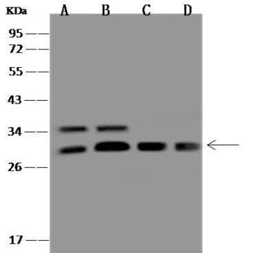 Western Blot: 26S proteasome subunit 9 Antibody [NBP3-05933]