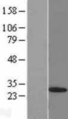 Western Blot: 26S proteasome subunit 9 Overexpression Lysate [NBL1-14906]