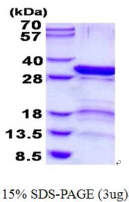 SDS-PAGE: Recombinant Human 26S proteasome subunit 9 His Protein [NBP2-23373]