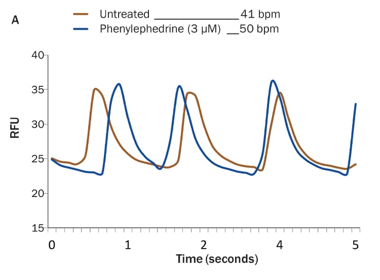 phenylephrine affects cardiomyocyte contraction rates