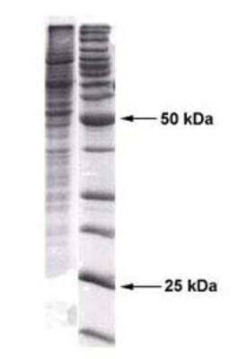 Western Blot: 293 Whole Cell Lysate [NB800-PC6]