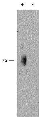 Western Blot: 2B4/CD244/SLAMF4 [p Tyr271] Antibody [NBP1-46104]