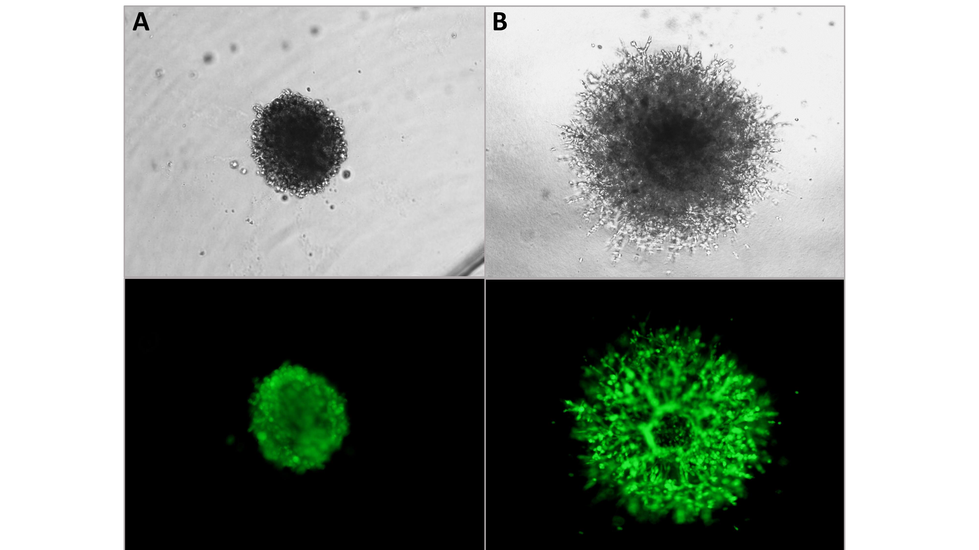 Spheroid Cell Invasion Assay_3500-096-K