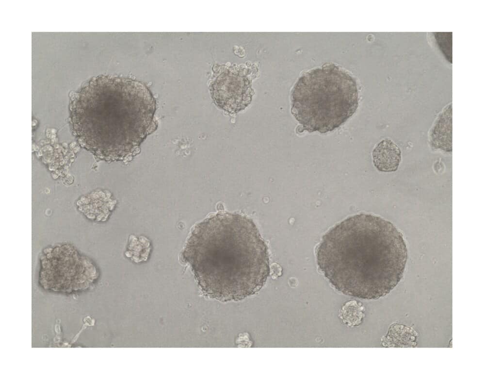 HepG2 Spheroids in Cultrex RGF BME, Type 2