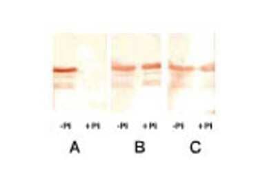 Western Blot: Troponin I Type 3 (cardiac) Antibody (22B11) [NB120-8290]