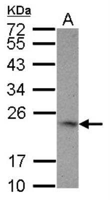 Western Blot: 4-1BB Ligand/TNFSF9 Antibody [NBP2-20673]