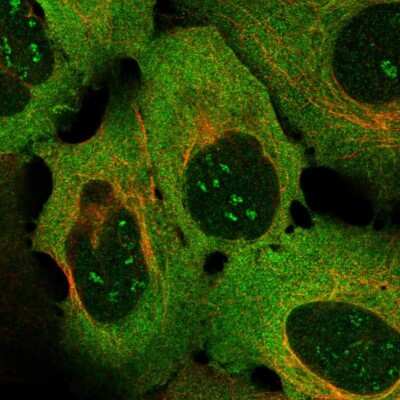 Immunocytochemistry/ Immunofluorescence: 4-1BB/TNFRSF9/CD137 Antibody [NBP2-56432]