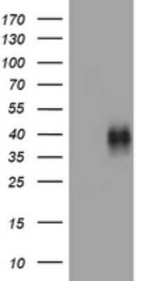 Western Blot: 4-1BB/TNFRSF9/CD137 Antibody (OTI5H5)Azide and BSA Free [NBP2-71035]