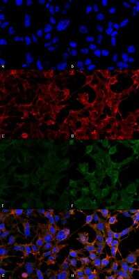 Immunocytochemistry/ Immunofluorescence: 4-Hydroxynonenal Antibody (12F7) [NBP2-59353]