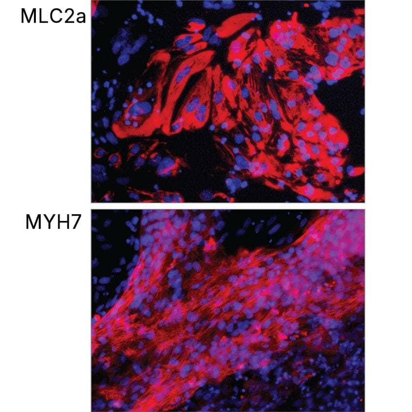 Staining for the Atrial Marker, MLC2a, and the Ventricular Marker, MYH7, in iPSC-derived Cardiomyocytes