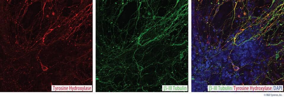 Staining of dopaminergic neurons with anti-tyrosine hydroxylase in red, anti-neuron-specific beta III tubulin Tuj1 in green and DAPI in blue
