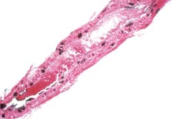 VasoTACS In Situ Apoptosis Detection Kit_Rat Artery Tissue