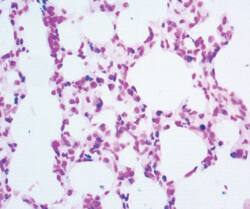 Mouse Lung Parenchyma Tissue_TACS XL In Situ Apoptosis Kit