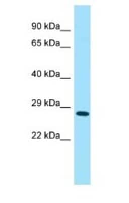 Western Blot: 4930567H17Rik Antibody [NBP1-98255]