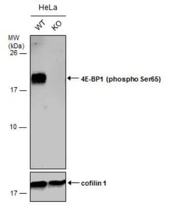 Western Blot: 4EBP1 [p Ser65] Antibody [NBP3-13171]