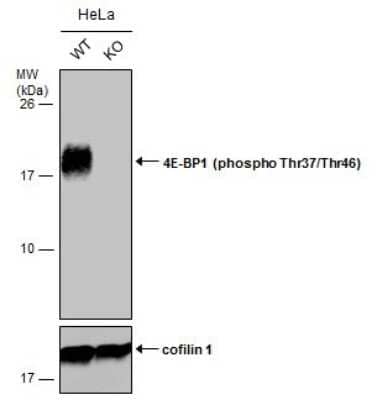 Western Blot: 4EBP1 [p Thr46, p Thr37] Antibody [NBP3-13170]