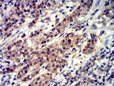 Immunohistochemistry: 4EBP1 Antibody (1E2E7) - BSA Free [NBP2-61900]
