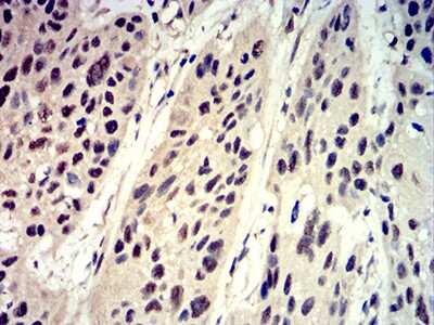 Immunohistochemistry: 4EBP1 Antibody (1E2E7) - BSA Free [NBP2-61900]