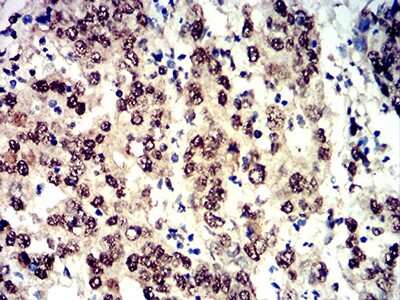 Immunohistochemistry: 4EBP1 Antibody (2D1G11) - BSA Free [NBP2-61901]