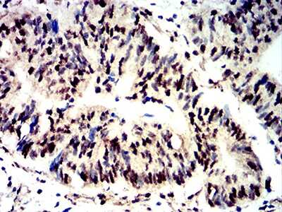 Immunohistochemistry: 4EBP1 Antibody (2D1G11) - BSA Free [NBP2-61901]