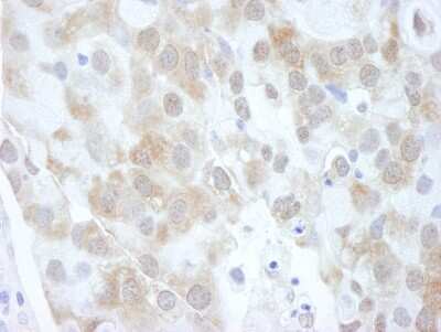 Immunohistochemistry: 4EBP1 Antibody [NB200-157]
