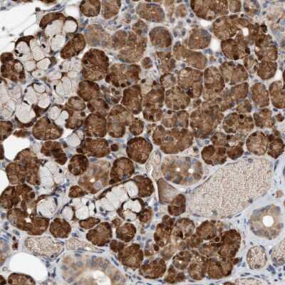 Immunohistochemistry-Paraffin: 4EBP1 Antibody [NBP1-89368]