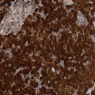 Immunohistochemistry-Paraffin: 4EBP1 Antibody [NBP1-89368]