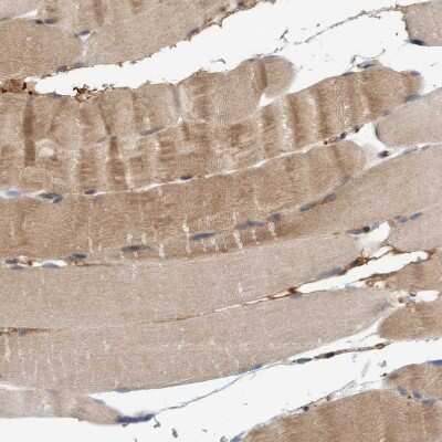 Immunohistochemistry-Paraffin: 4EBP1 Antibody [NBP1-89368]