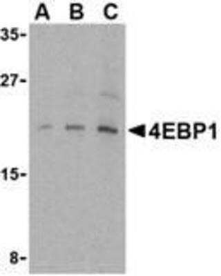 Western Blot: 4EBP1 AntibodyBSA Free [NBP1-76621]