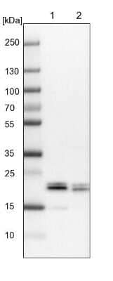 Western Blot: 4EBP1 Antibody [NBP1-89368]