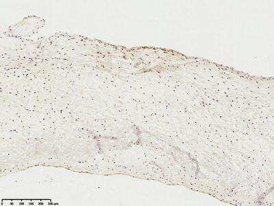Immunohistochemistry: 5'-Nucleotidase/CD73 Antibody [NBP1-85740]