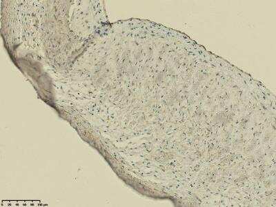 Immunohistochemistry: 5'-Nucleotidase/CD73 Antibody [NBP1-85740]
