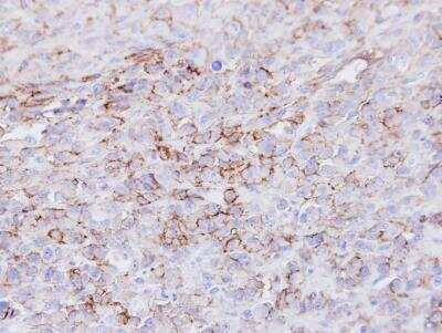Immunohistochemistry-Paraffin: 5'-Nucleotidase/CD73 Antibody [NBP1-32951]