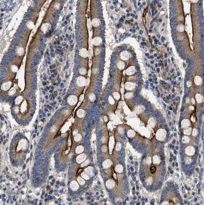 Immunohistochemistry-Paraffin: 5'-Nucleotidase/CD73 Antibody [NBP1-85740]