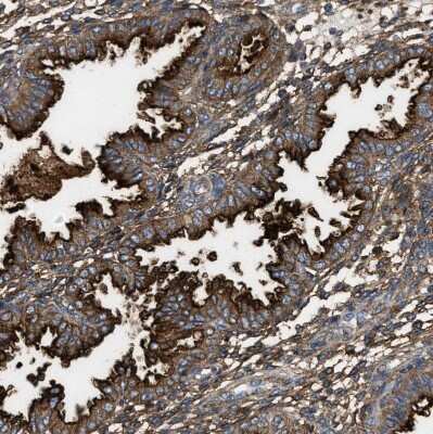 Immunohistochemistry-Paraffin: 5'-Nucleotidase/CD73 Antibody [NBP1-85740]