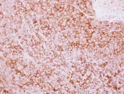 Immunohistochemistry-Paraffin: 5'-Nucleotidase/CD73 Antibody [NBP2-15815]