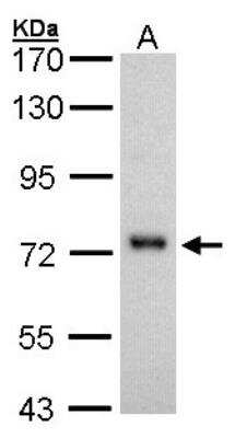 Western Blot: 5'-Nucleotidase/CD73 Antibody [NBP1-32951]